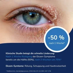 ALLERGIKA® Augenlidcreme MED| Clearance