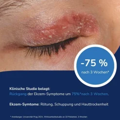 ALLERGIKA® Augenlidcreme MED| Clearance