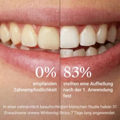 ALPINE WHITE Whitening Stripes| Hot