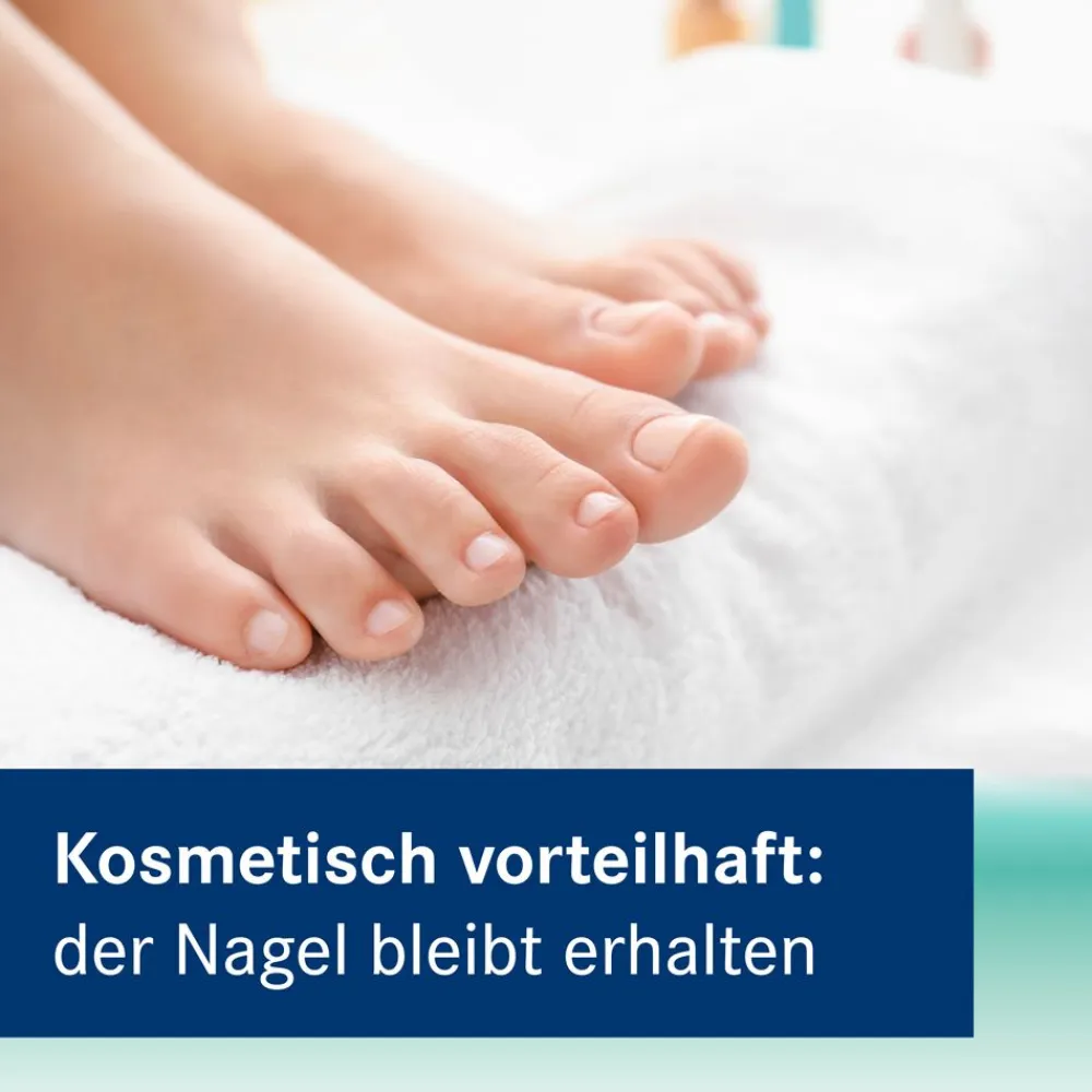 Nagelkur Heumann 5% wirkstoffhaltiger Nagellack>Amorolfin