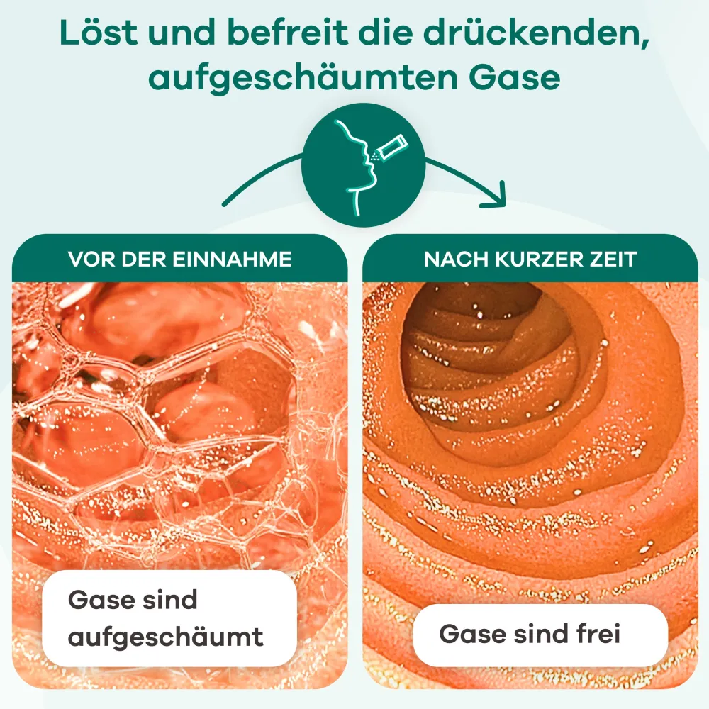Novacalm bei gasbedingten Magen-Darm-Beschwerden>apriwell Outlet