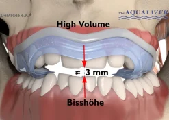 Aqualizer Slim High / Bisshöhe 3 mm> Online