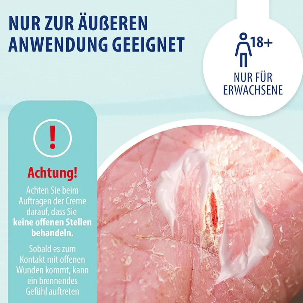Behrend – Schuppenflechte & Neurodermitis Creme bei geröteter, trockener & schuppiger Haut – Psoriasis & Ekzem Salbe reduziert den Juckreiz & beruhigt entzündete Haut> Hot