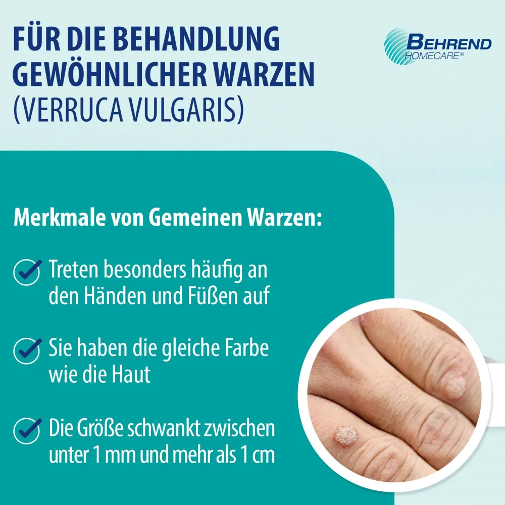 Behrend Warzenmittel für Hand & Fuß - Effektive Warzen Verätzung ohne Schmerzen - Hygienisch & sicher> Discount