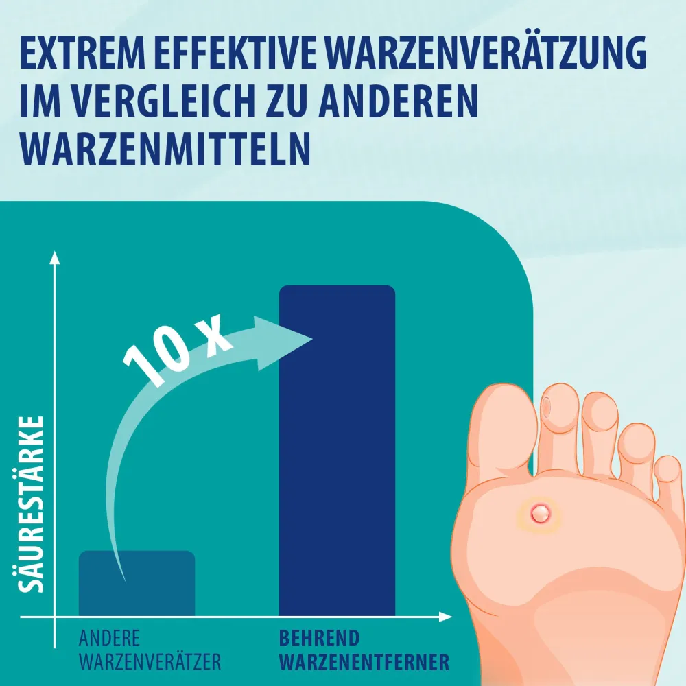 Behrend Warzenmittel für Hand & Fuß - Effektive Warzen Verätzung ohne Schmerzen - Hygienisch & sicher> Discount