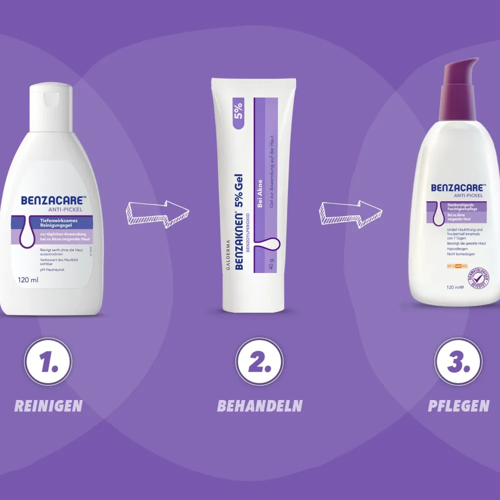 ® 5% Gel>Benzaknen Hot