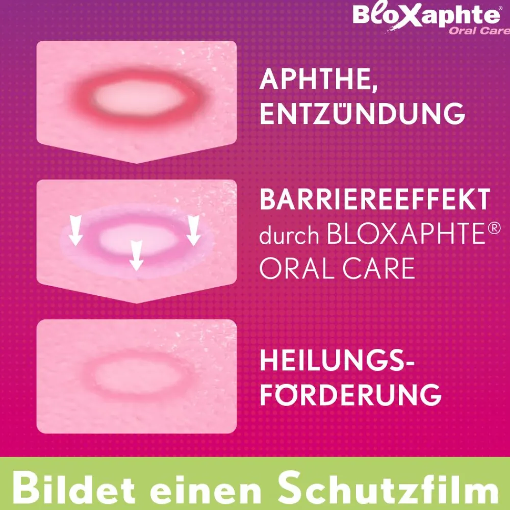 BloXaphte® Oral Care Junior-Gel| Sale