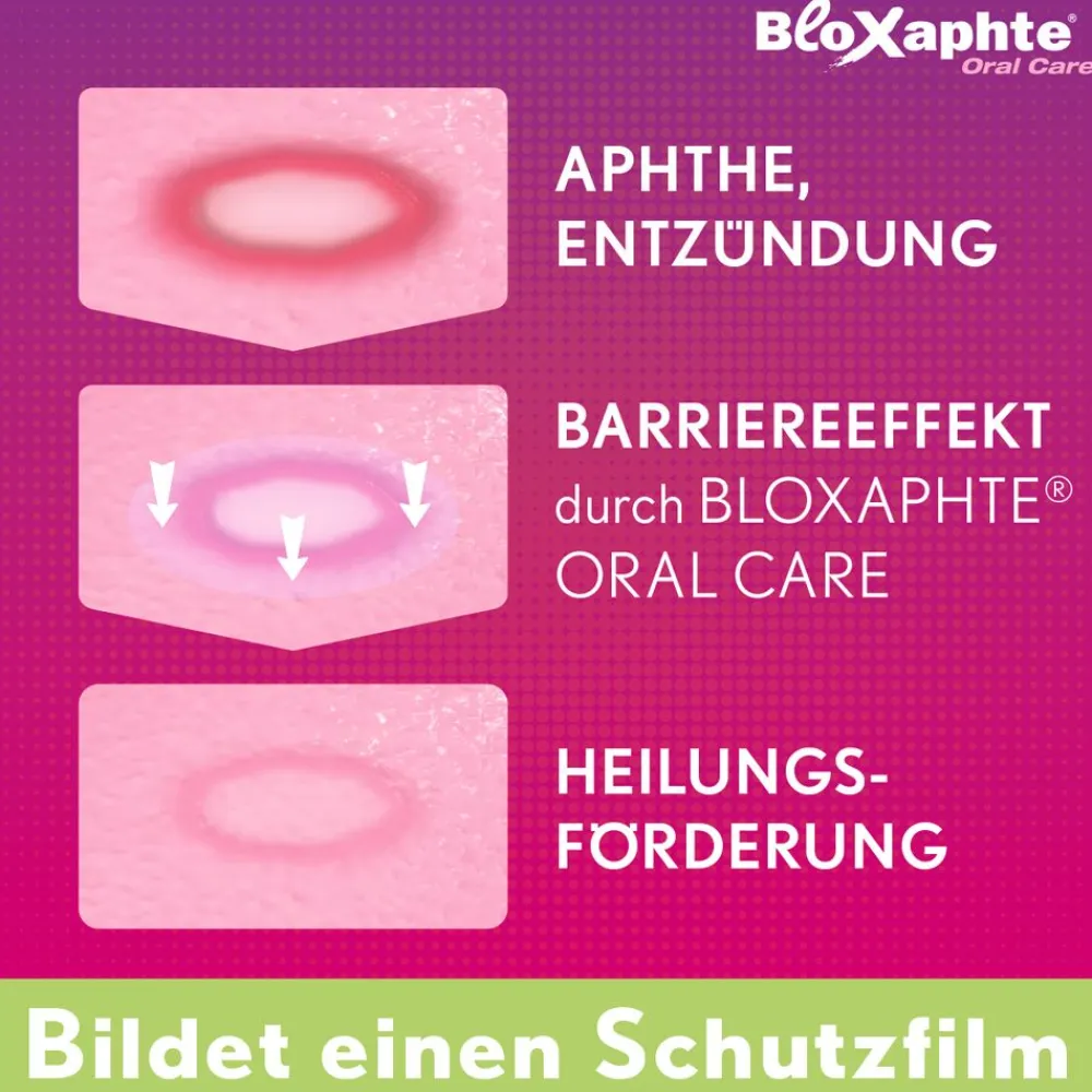 BloXaphte® Oral Care Mundspray| Online