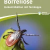 Borreliose| New