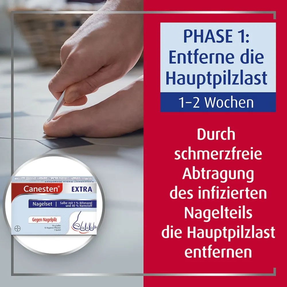 ® EXTRA 2-Phasen-Kurztherapie-Set bei Nagelpilz>Canesten Sale