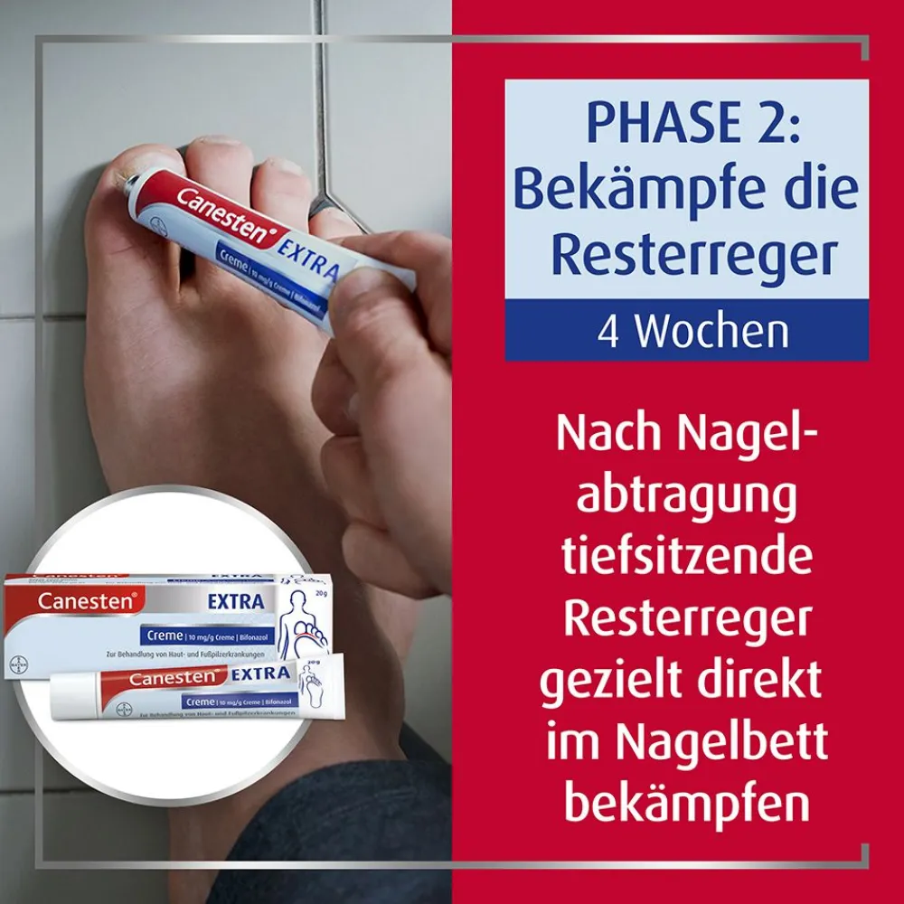 ® EXTRA 2-Phasen-Kurztherapie-Set bei Nagelpilz>Canesten Sale