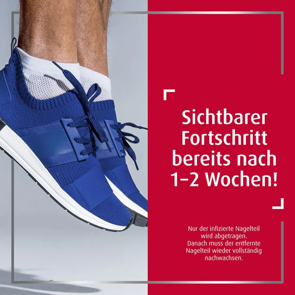 ® EXTRA 2-Phasen-Kurztherapie-Set bei Nagelpilz>Canesten Sale