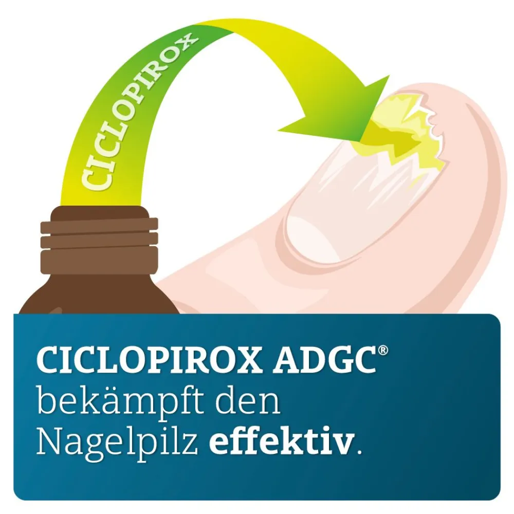 CICLOPIROX ADGC® wirkstoffhaltiger Nagellack gegen Nagelpilz inkl. Set| Hot