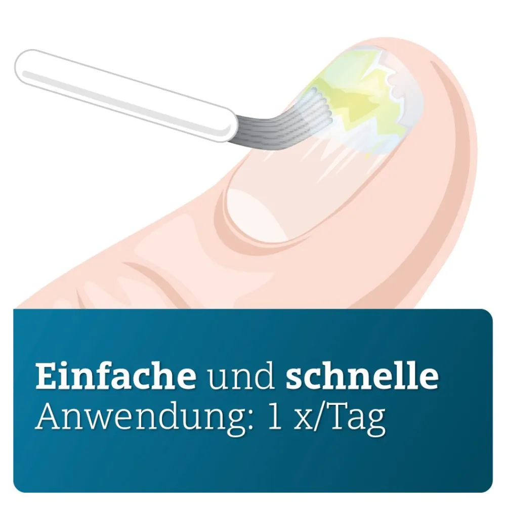 CICLOPIROX ADGC® wirkstoffhaltiger Nagellack gegen Nagelpilz inkl. Set| Hot