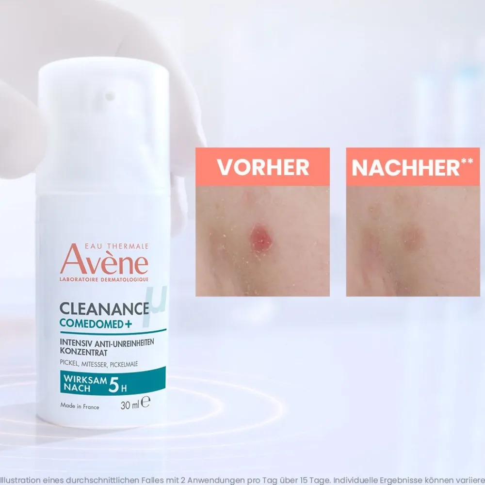 Cleanance Comedomed+ Intensiv Anti-Unreinheiten Konzentrat|Avène Hot