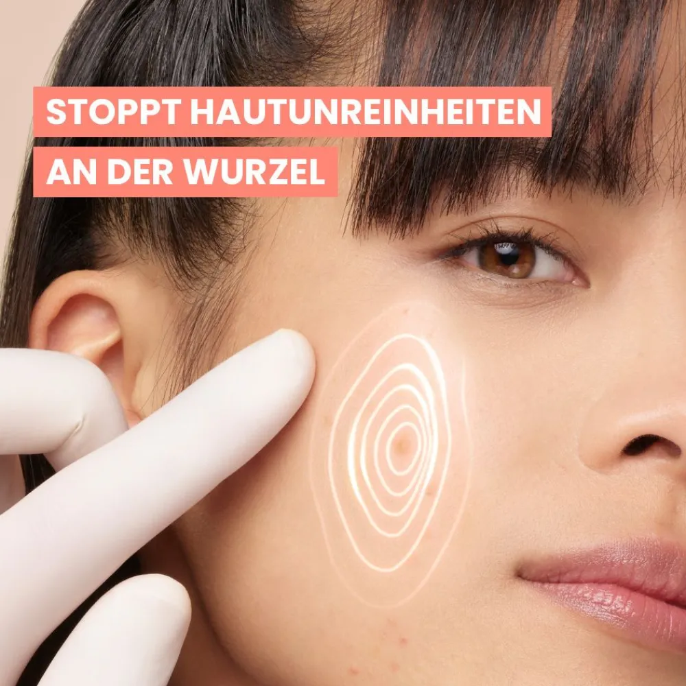 Cleanance Comedomed+ Intensiv Anti-Unreinheiten Konzentrat|Avène Hot