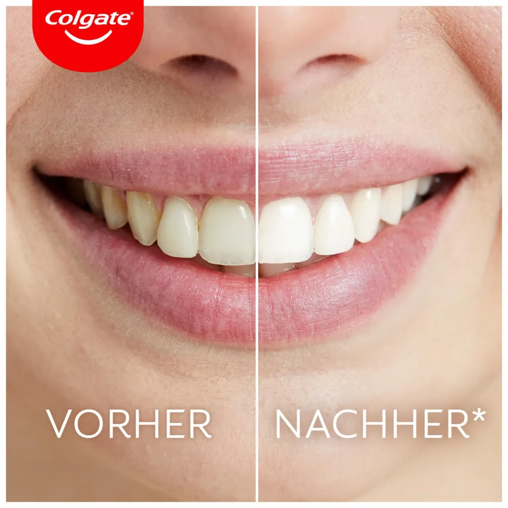 ® Max White Ultimate LED-Whitening-Kit mit KomfortFit-Adapter|Colgate