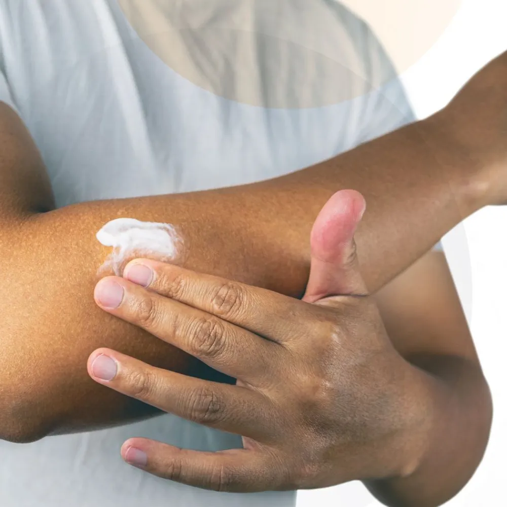 Diclofenac AL Schmerzgel 10 mg / g für akute Muskelschmerzen bei Erwachsenen>