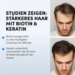 Dr. Balwi Biotin & Keratin Tabletten – Zur Unterstützung von Haarwachstum und Haarstruktur| Outlet