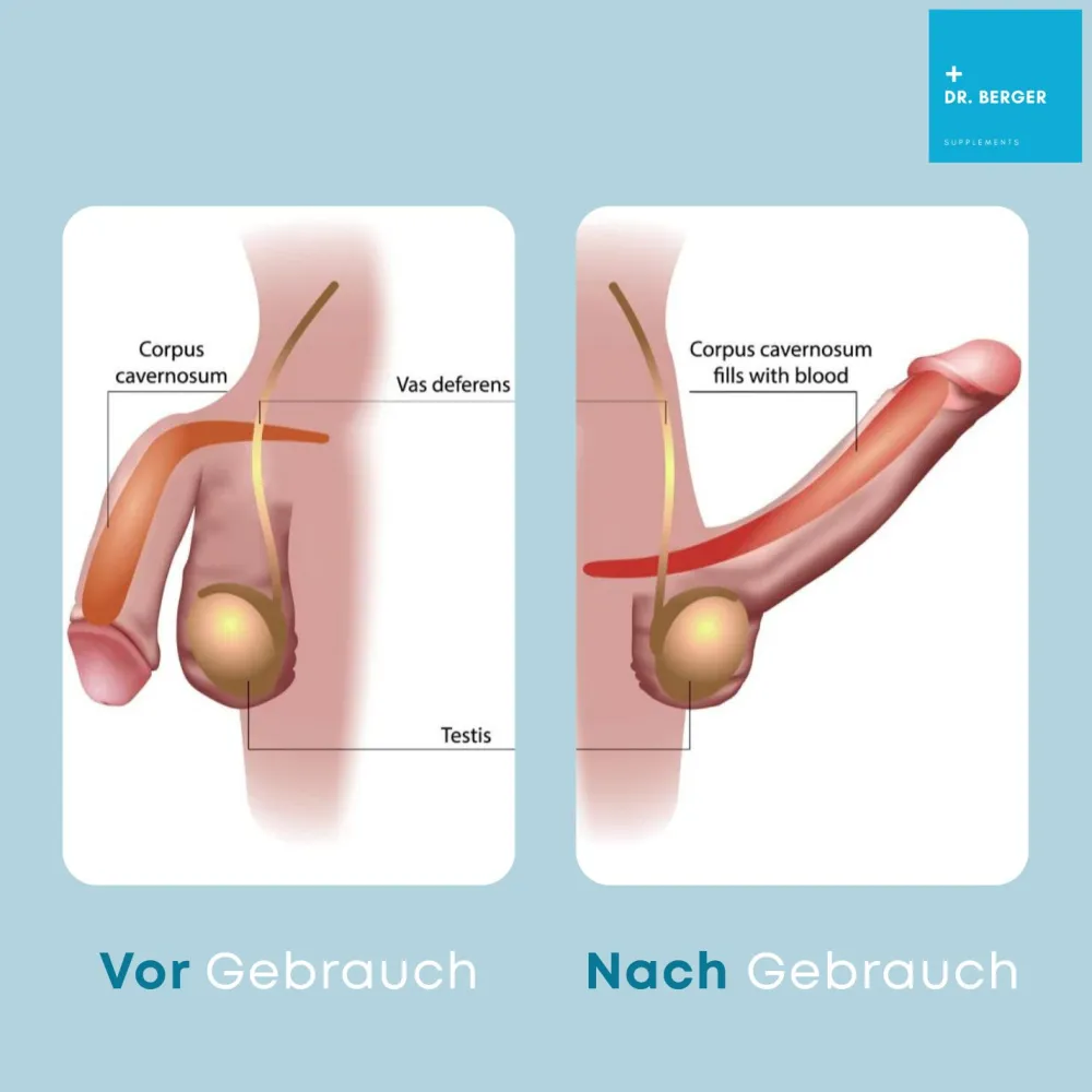 ® Male Formula – Natürliches Potenzmittel für Männer – Alternative zu Viagra und Kamagra>Dr. Berger Clearance