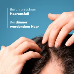 DUCRAY Anaphase Shampoo bei chronischem Haarausfall| Clearance