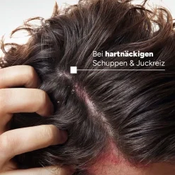 DUCRAY KELUAL ELUTION Anti-Schuppen Begleitpflege-Shampoo| Online
