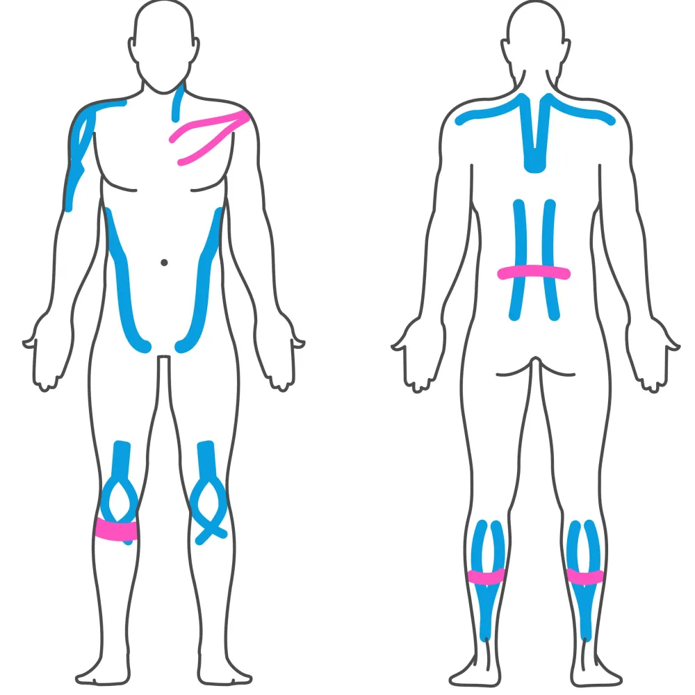 Effekt Manufaktur Kinesiologie Tape – 500 x 5 cm – in blau und pink - Kinesiotape - MEDIZINPRODUKT| Best