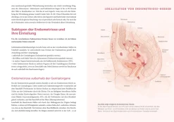 Endometriose - Die unterschätzte Krankheit| Outlet