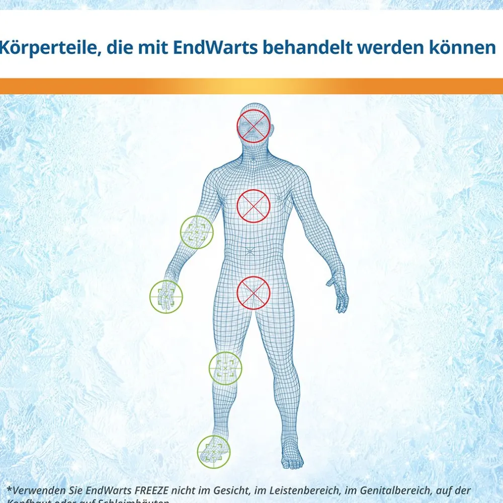 FREEZE: Vereisungsmittel zur Entfernung von Warzen an Händen, Armen & Füßen|EndWarts Best
