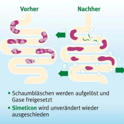 ® Gold Perlen gegen Blähungen><noscript><img width=