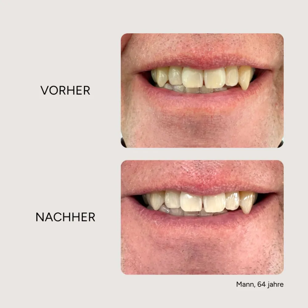 Etinour Essential Whitening & Remineralisierungskit> Sale