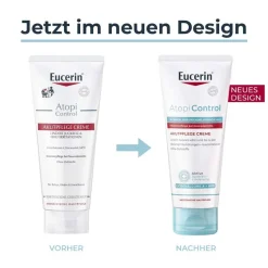® AtopiControl Akutpflege Creme hilft wirksam bei akuten Neurodermitisschüben, gegen Juckreiz, Hautrötungen und Entzündungen - Jetzt 20 % mit dem Code 20 sparen>Eucerin New
