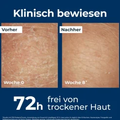 ® UreaRepair 10% Urea Intensive Feuchtigkeitslotion – Körperlotion für sehr trockene bis extrem trockene Haut - Jetzt 20 % mit dem Code 20 sparen|Eucerin Online