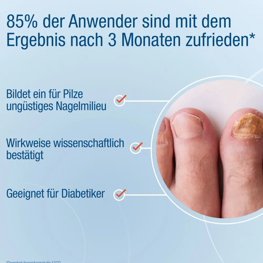 ® Anti-Nagelpilz Liquid - Nagelpilz Nagellack für Füsse und Hände - Wissenschaftlich bestätigte Wirkweise>Evolsin Online