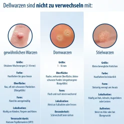 Evolsin® Dellwarzen Mittel I Für Erwachsene & Kinder ab 2 Jahren I Dellwarzen Behandlung mit Ätzkali><noscript><img width=