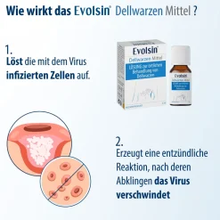 Evolsin® Dellwarzen Mittel I Für Erwachsene & Kinder ab 2 Jahren I Dellwarzen Behandlung mit Ätzkali><noscript><img width=