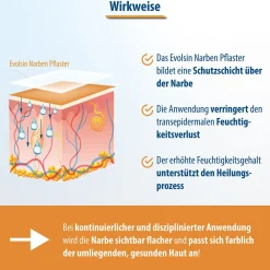 Evolsin® Transparentes Narbenpflaster – für Narben aller Art – Narbenpflaster aus Silikon reduziert sichtbar Narben - für eine einfache Behandlung (200 cm)| Outlet