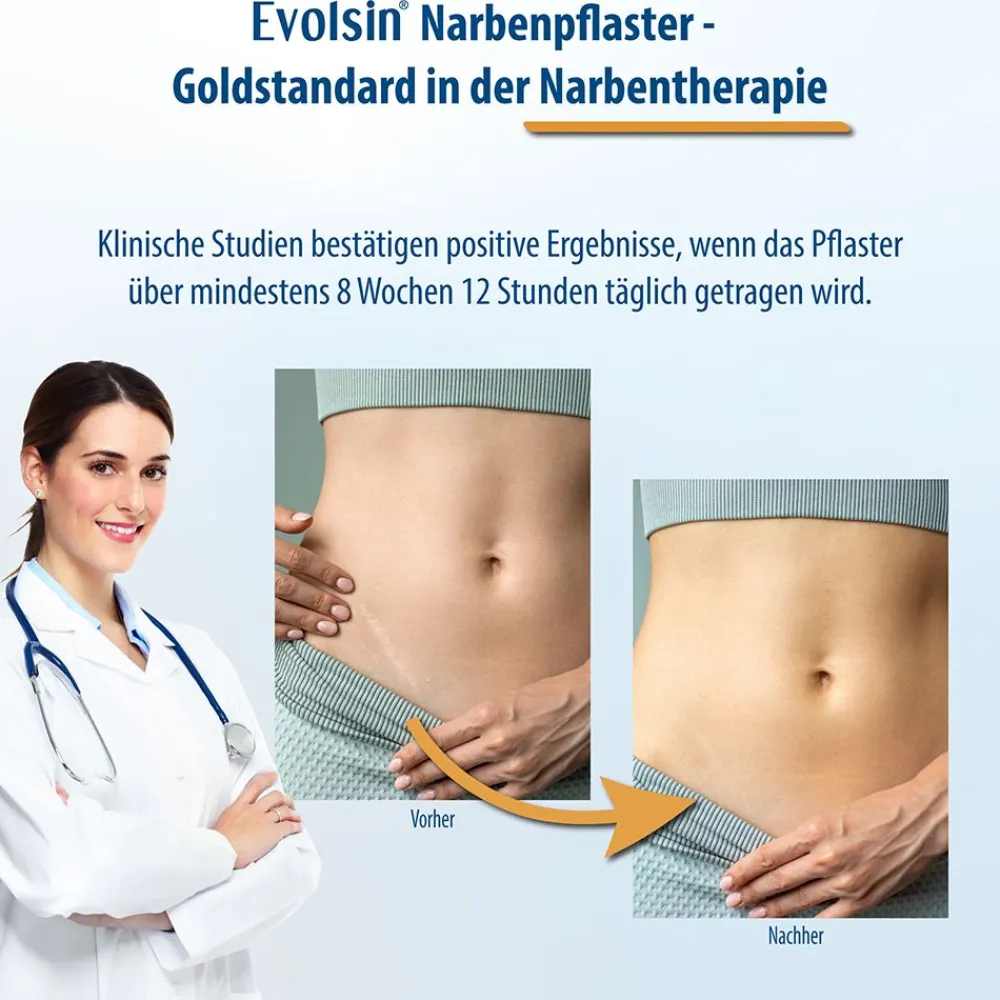 Evolsin® Transparentes Narbenpflaster – für Narben aller Art – Narbenpflaster aus Silikon reduziert sichtbar Narben - für eine einfache Behandlung (200 cm)| Outlet