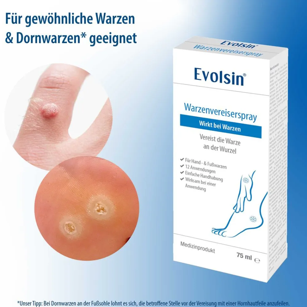 ® Warzenvereiser – Entfernung von Warzen und Dornwarzen sicher & effektiv|Evolsin Online