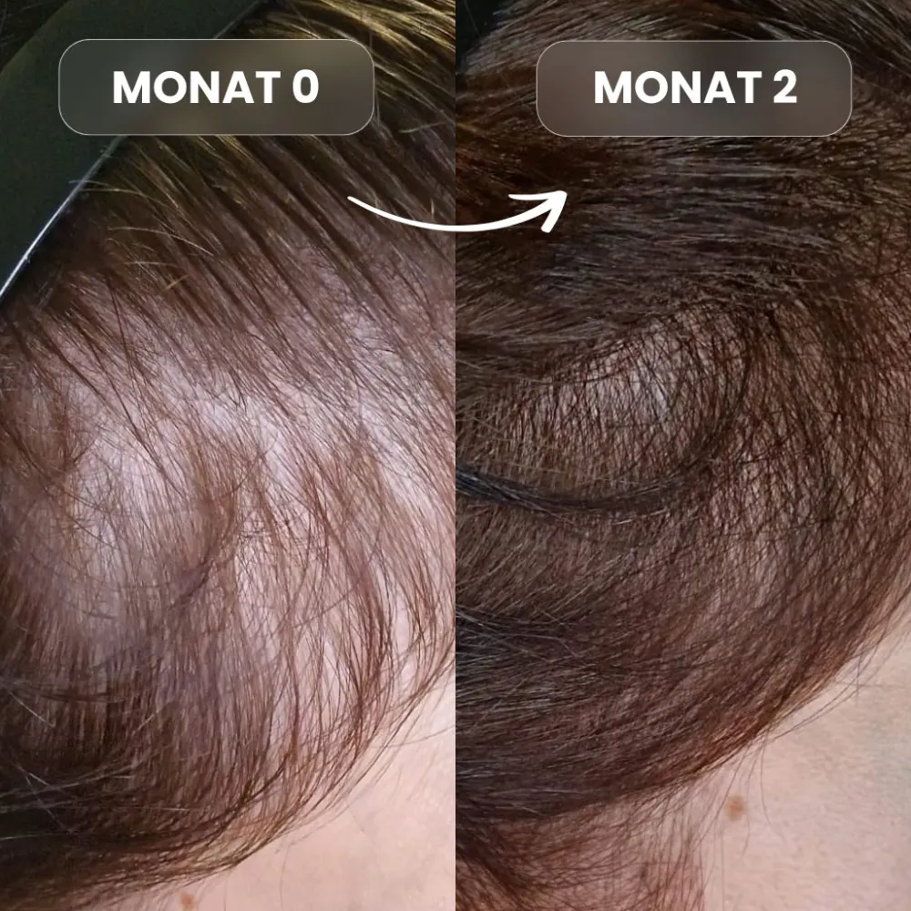 Growfine® Haarkapseln>