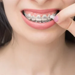 ® Ortho Wachs Geschmacksneutral|Gum Hot