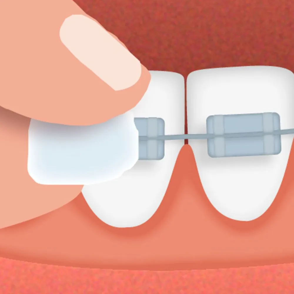 ® Ortho Wachs Geschmacksneutral|Gum Hot
