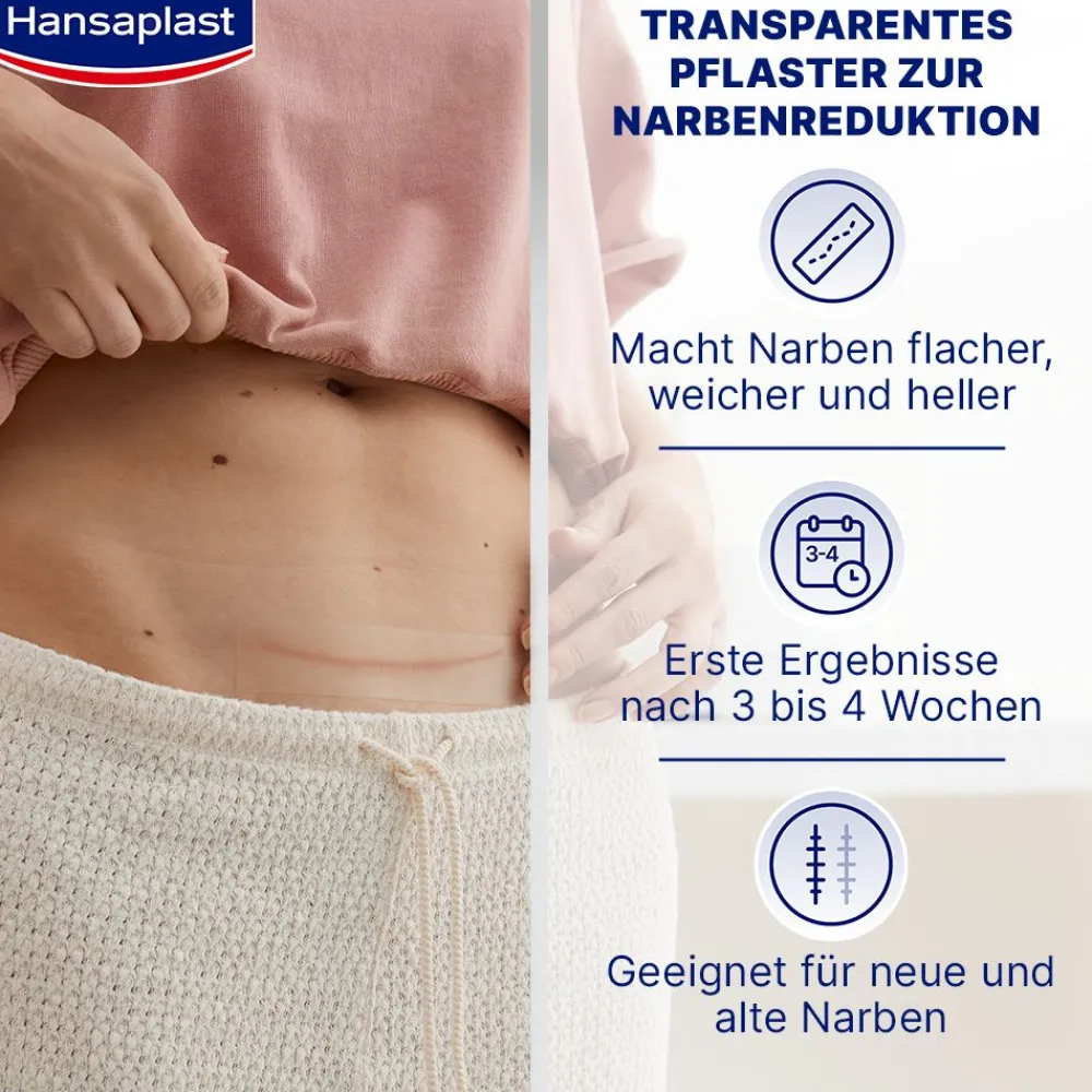 Narben Reduktion XL | Pflaster für Narben | Wasserfeste Narbenpflaster | 21 Stk. - Jetzt 20% mit dem Code hp20 sparen>Hansaplast Hot