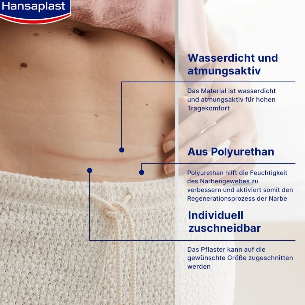 Narben Reduktion XL | Pflaster für Narben | Wasserfeste Narbenpflaster | 21 Stk. - Jetzt 20% mit dem Code hp20 sparen>Hansaplast Hot