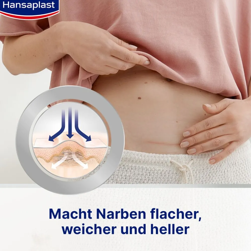 Narben Reduktion XL | Pflaster für Narben | Wasserfeste Narbenpflaster | 21 Stk. - Jetzt 20% mit dem Code hp20 sparen>Hansaplast Hot