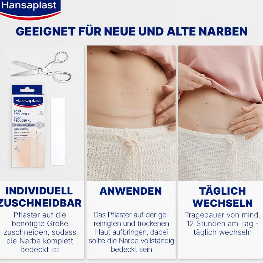 Narben Reduktion XL | Pflaster für Narben | Wasserfeste Narbenpflaster | 21 Stk. - Jetzt 20% mit dem Code hp20 sparen>Hansaplast Hot