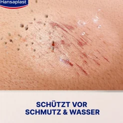 Zweite Haut Schutz | Wasserdichtes Sprüh-Pflaster | Flexible Sprühpflaster - Jetzt 20% mit dem Code hp20 sparen><noscript><img width=