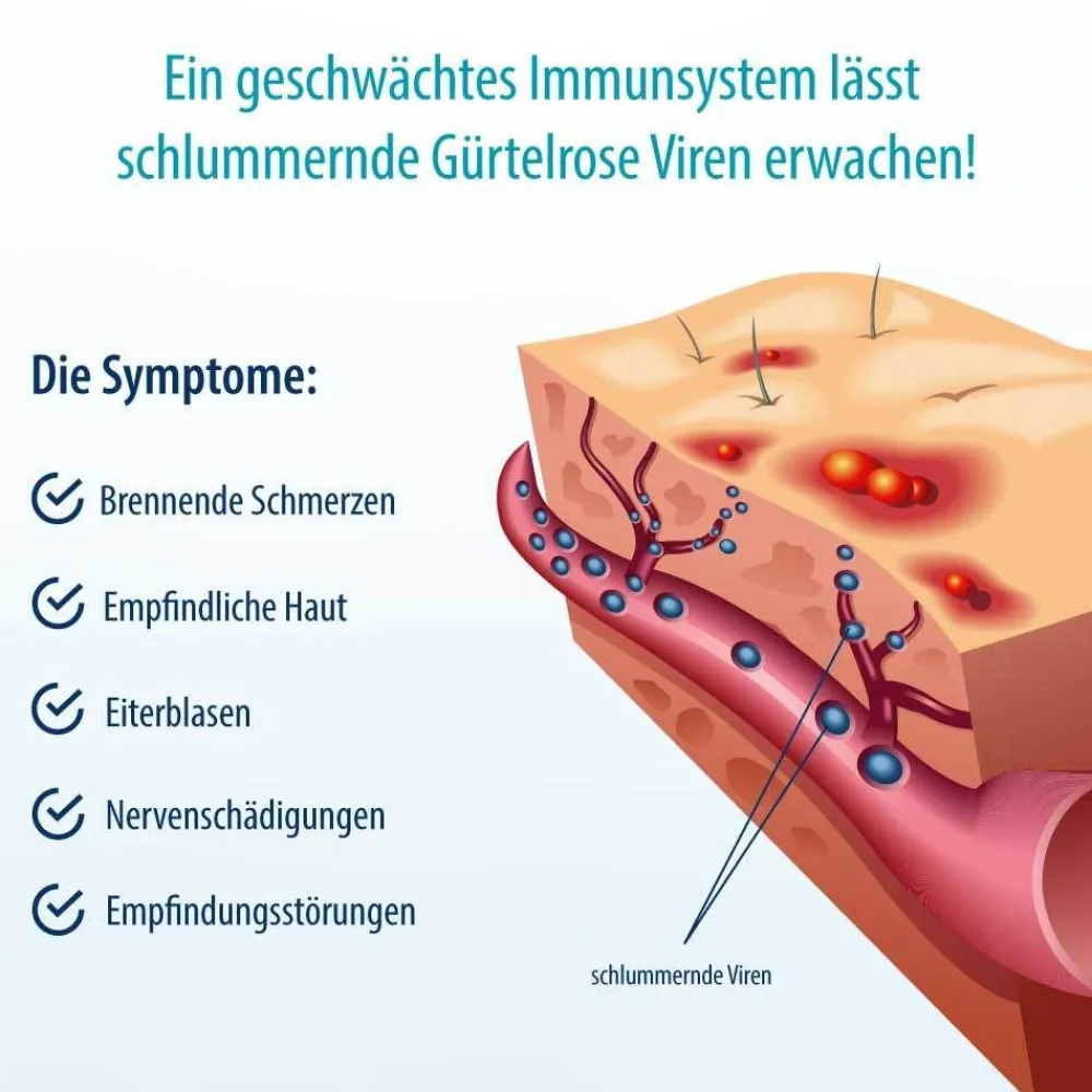 Herpasogel bei Gürtelrose | Fördert die Normalisierung der Haut bei Herpes zoster> Hot