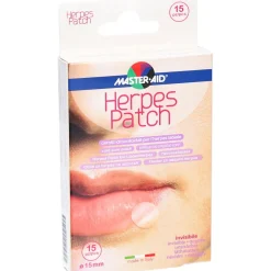 Herpespatch bei Lippenherpes><noscript><img width=
