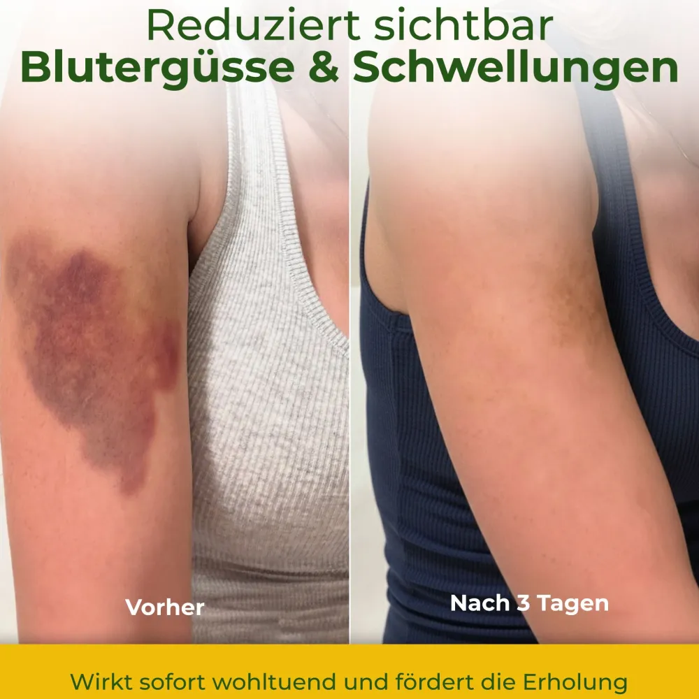 H4H Naturals® Arnika Salbe & Pferdesalbe Gel Linderung bei Knie, Gelenk, Nacken & Muskel> Clearance